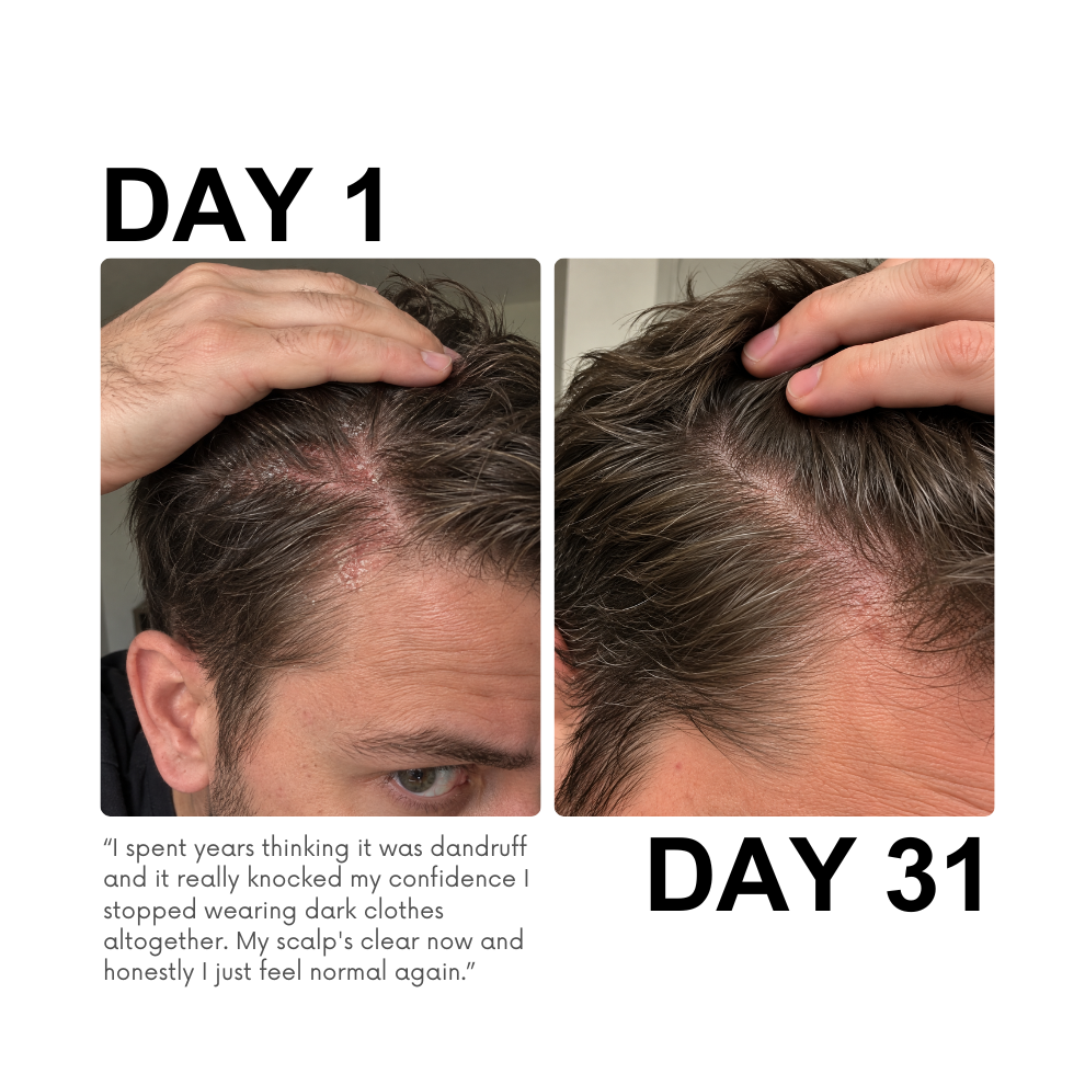 Rescue & Reset Serum