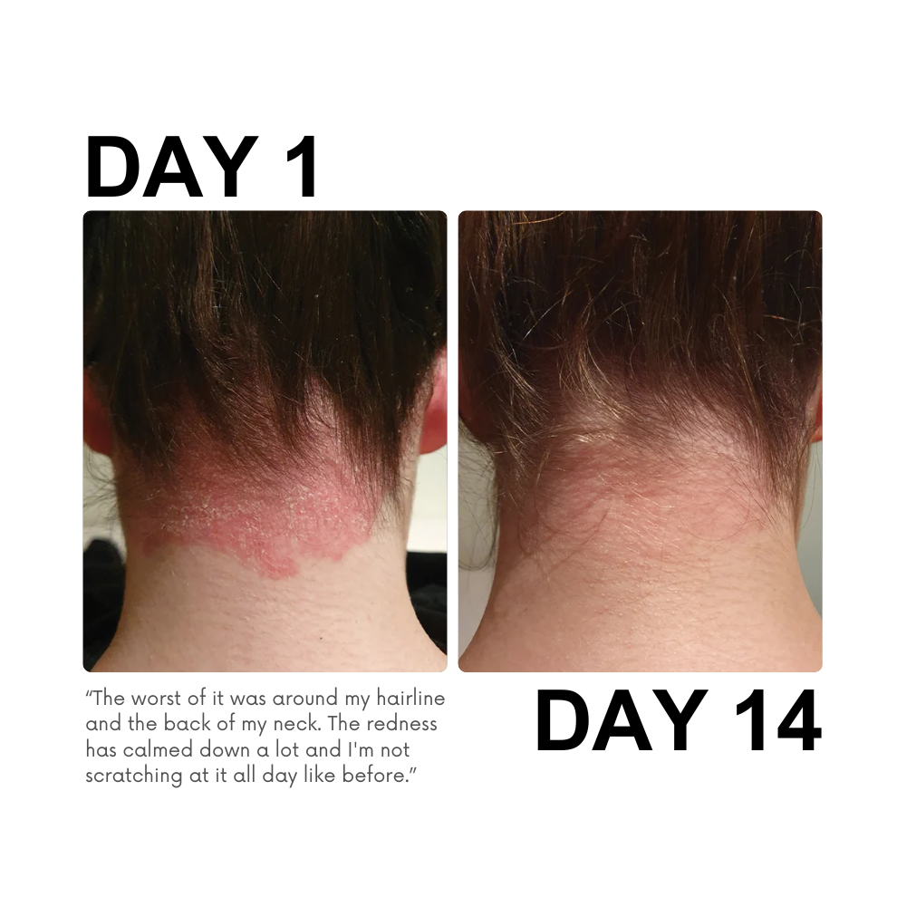 Rescue & Reset Serum